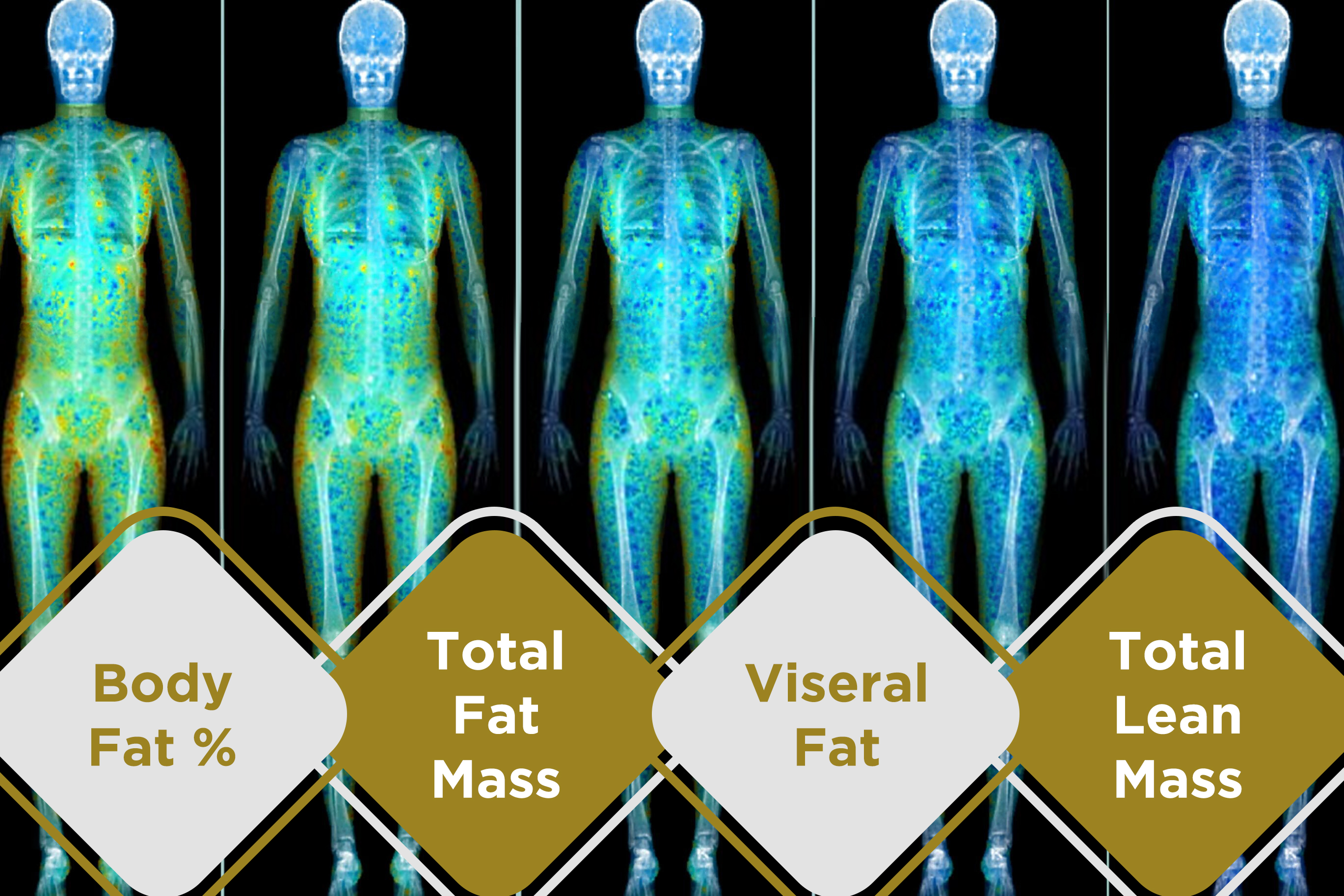 sexa-scan-results